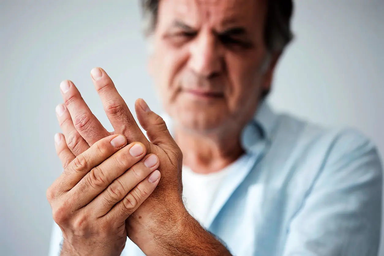 arthritis